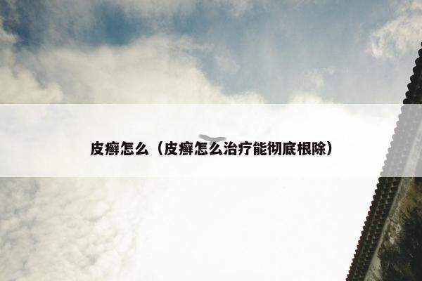 皮癣怎么（皮癣怎么治疗能彻底根除）