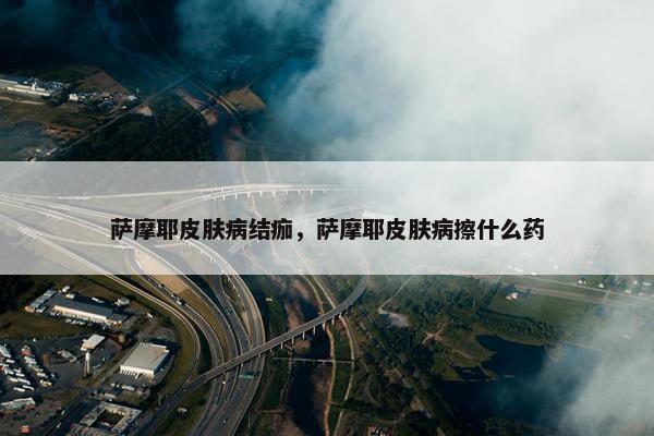 萨摩耶皮肤病结痂，萨摩耶皮肤病擦什么药