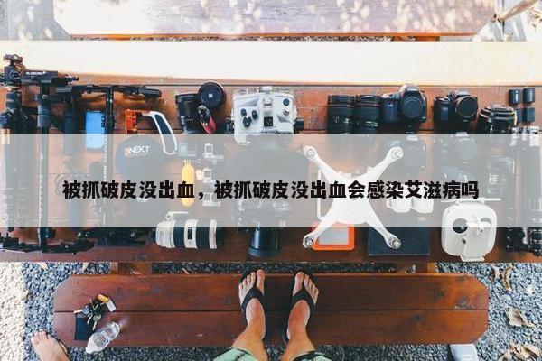 被抓破皮没出血，被抓破皮没出血会感染艾滋病吗